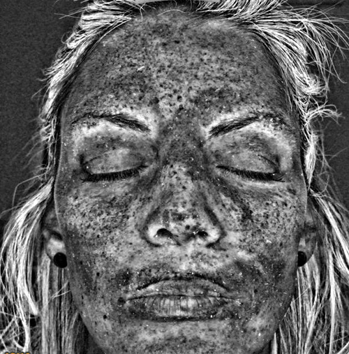 تصویر هولناک از آسیب‌های نامرئی حمام آفتاب با اسکن پیشگامانه محققان