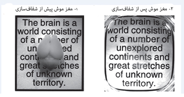 transparent brain 2