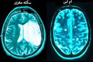 [تصویر:  princ_rm_photo_of_damaged_brains.jpg]