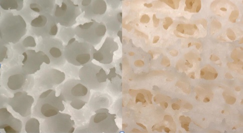 material