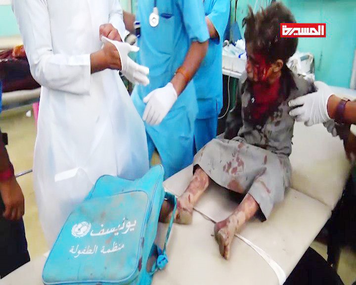 ایران جنایت هولناک سعودی‌ها در یمن را به‌شدت محکوم کرد