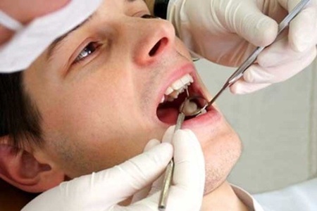 هر ایرانی ۳۵ تا ۴۵ ساله، ۱۳ دندان خراب دارد