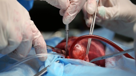 جزئیات انجام اولین انتقال هوایی قلب بیمار مرگ مغزی