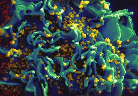 تولید دارویی برای درمان ایدز و ویروس HIV