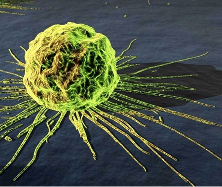 کشف محرکی که سلول‌های سرطانی سینه را تهاجمی‌تر می‌کند