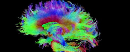 کشف منشا فیزیکی خودآگاهی در مغز