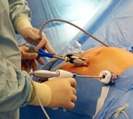 جراحی کوچک کردن معده باید درمان استاندارد دیابت شود