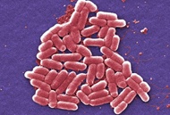 شناسایی نخستین مورد میکروب مقاوم به همه آنتی‌بیوتیک‌ها در آمریکا