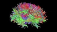 ساخت تصویر هولوگرامی از مغز انسان