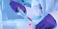موفقیت محققان ایرانی در ارائه سلول‌درمانی برای بیماری ژنتیکی کیست‌های کلیه
