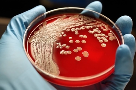 سازمان ملل درباره باکتری‌های مقاوم به آنتی‌بیوتیک تشکیل جلسه می‌دهد