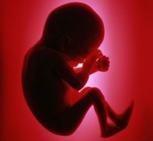 کشف اسرار بارداری با استفاده از تصویربرداری سه بعدی