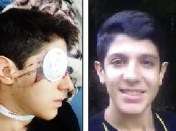 تیراندازی به چشم پسر نوجوان در ایستگاه صلواتی