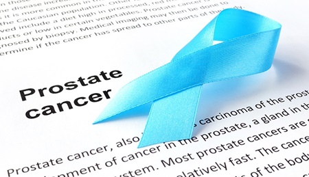نکته بهداشتی: سرطان پروستات