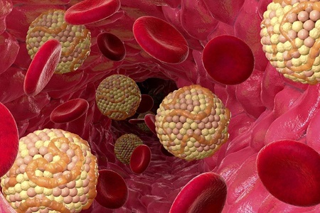 آشنایی با علائم افزایش سطح کلسترول خون