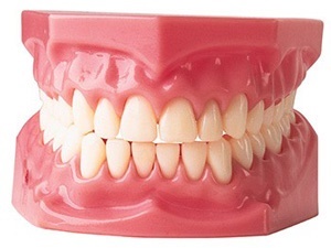 دندان مصنوعی موجب سوء تغذیه می‌شود