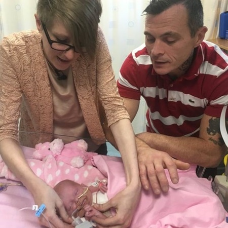 جراحی موفق نوزادی که با قلب بیرون از بدن متولد شده بود