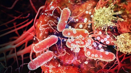 کمک گرفتن از یک باکتری سمی برای جنگ با سرطان