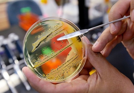 سازمان جهانی بهداشت فهرست ۱۲ باکتری خطرناک را منتشر کرد