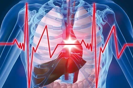 ارتباط گُرگرفتگی با خطر ابتلا به بیماری قلبی