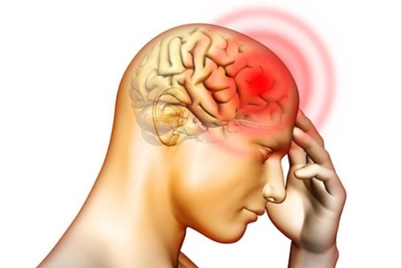 آشنایی با سردردهای خطرناک/ سردرد صبح را جدی بگیرید