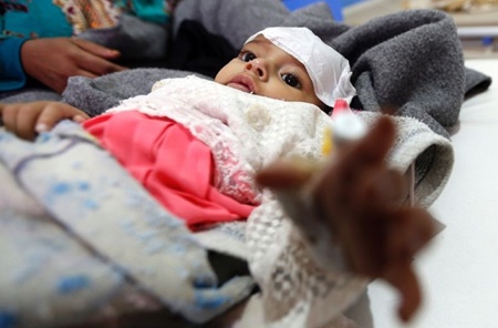 موارد وبا در یمن تا شهریور ممکن است از مرز ۳۰۰۰۰۰ بگذرد