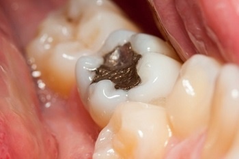 دندانپزشکی به طرح تحول افزوده می‌شود
