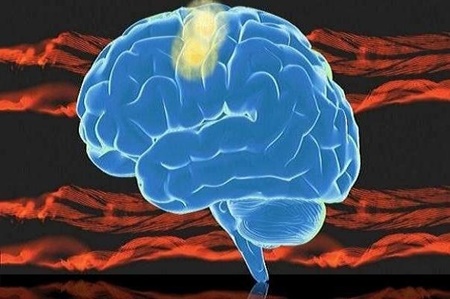 آسیب شدید به سر خطر زوال عقل در سنین بالا را افزایش می‌دهد