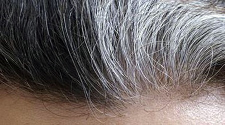 تغییر ظاهر موها خبر از کدام بیماری‌ها می‌دهد؟