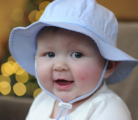 نکته بهداشتی: محافظت نوزادان از آفتاب
