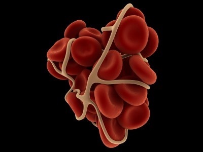 نکته بهداشتی: عوامل افزاینده خطر لخته شدن خون