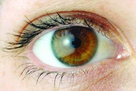 تشخیص دیابت از روی تصویر شبکیه چشم | پیش‌بینی بیماری در ۳۰ثانیه