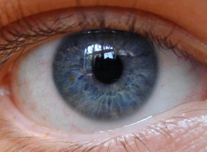 بیماری‌های چشمی که با آلزایمر ارتباط دارند