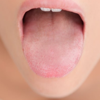 نکته بهداشتی: مشکلات دهانی در درمان سرطان