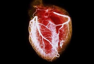 نکته بهداشتی: کاستن خطر بیماری قلبی