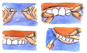 چگونگی نخ کشیدن دندان