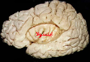 اینسولا ساختاری در عمق مغز که د راعتیاد دخیل است