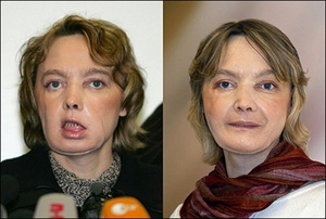 چهره دینور در فوریه(چپ) و نوامبر 2006