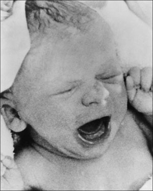 لوئیس براون اولین نوزاد آزمایشگاهی جهان در سال 1978- AFP