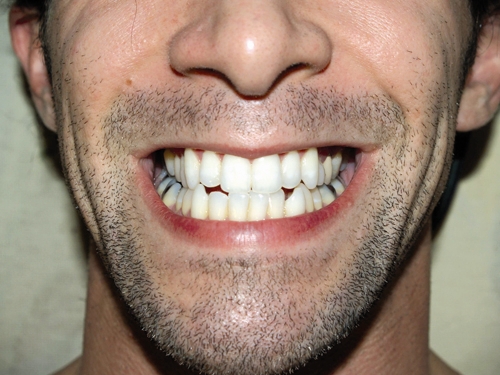 سلامت - دندان