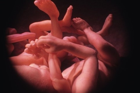 Menschliche Zwillinge im Mutterleib