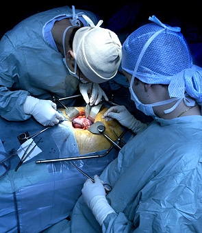 organ transplant