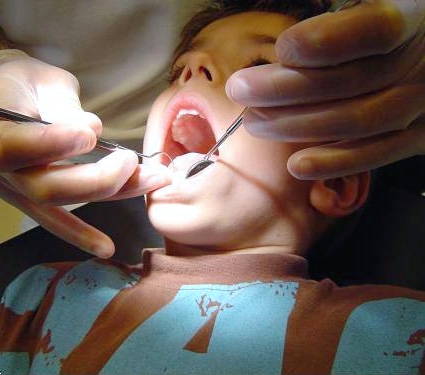 دندان کودک