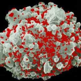 تزریق سلول های بنیادی دست ورزی شده انسان برای نابودی ایدز 