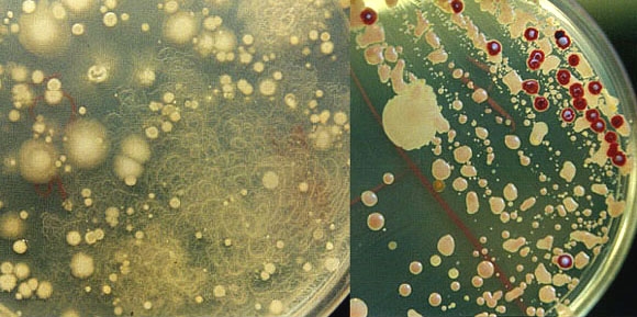 Bacillus mycoides