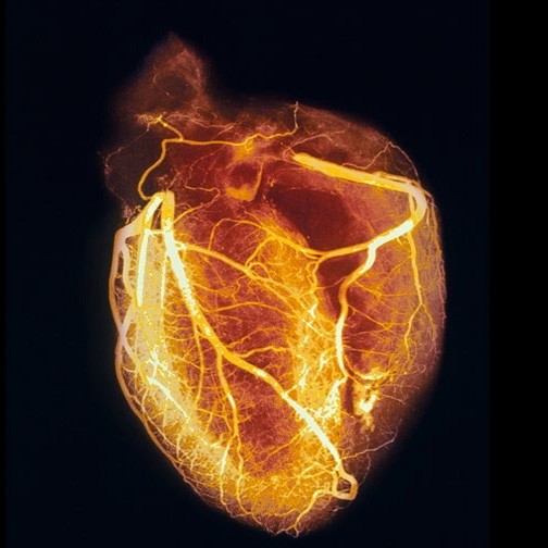 مدلی سه بعدی برای درک تأثیر استرس بر روی قلب
