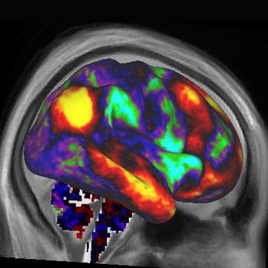 اسکن مغزی افراد بیهوش به روش تازه
