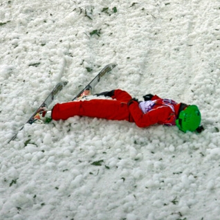 ضربه مغزی یک زن ورزشکار در سوچی