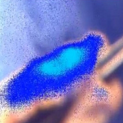 مهندسی سلولی، شیوه‌ای نوین در درمان سرطان