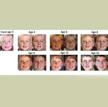 پیش‌بینی چهره کودکان در بزرگسالی 